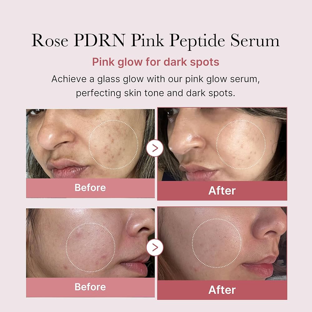 MEDICUBE Collagen PDRN Pink Peptide Serum 30ml