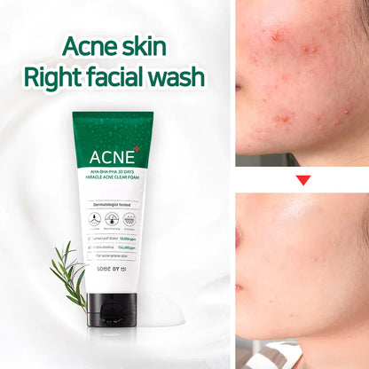 AHA, BHA, PHA 30 Days Miracle Acne Clear Foam