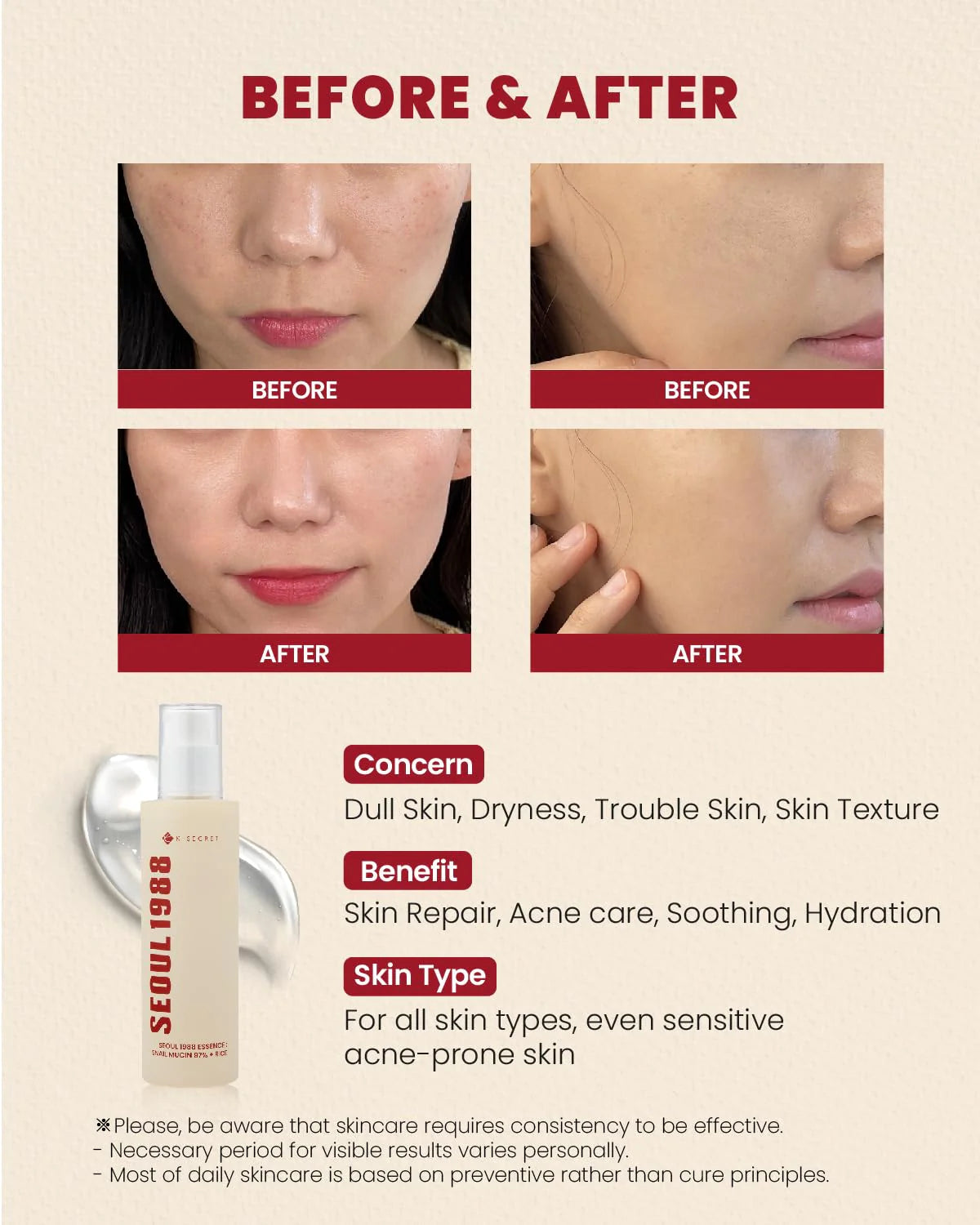 K-SECRET SEOUL 1988 Essence : Snail Mucin 97% + Rice 100ml